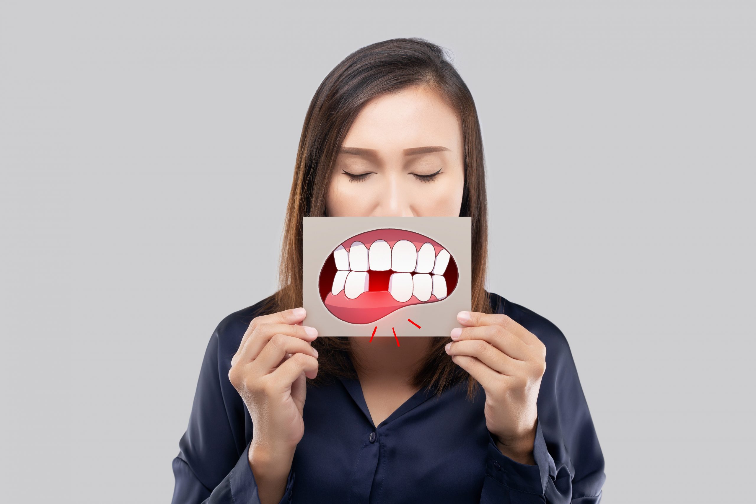 Les conséquences du non-remplacement des dents extraites ou absentes –  L'Information Dentaire