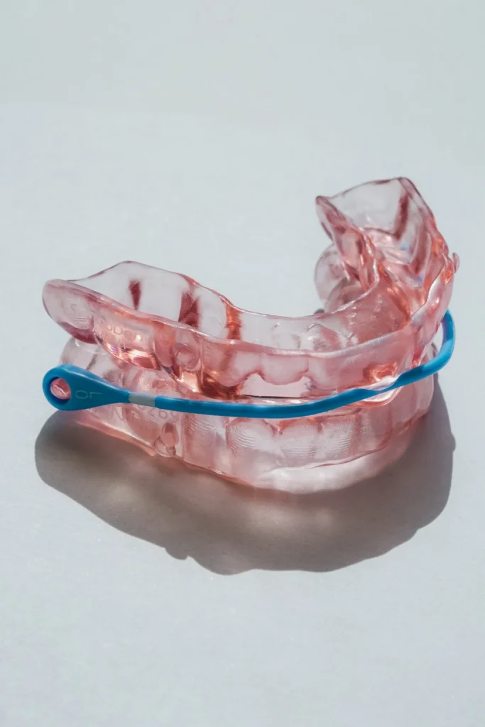 Appareil orthodontique fonctionnel transparent utilisé pour corriger l’alignement des dents