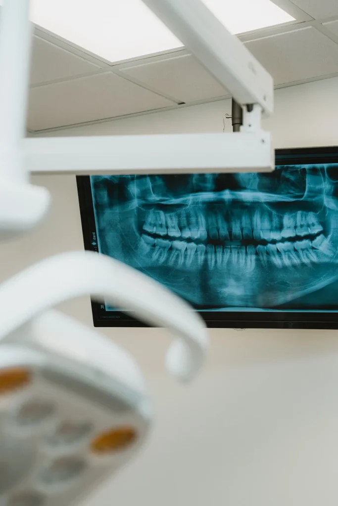 Radiographie panoramique des dents affichée sur un écran dans une salle d’examen d’une clinique dentaire