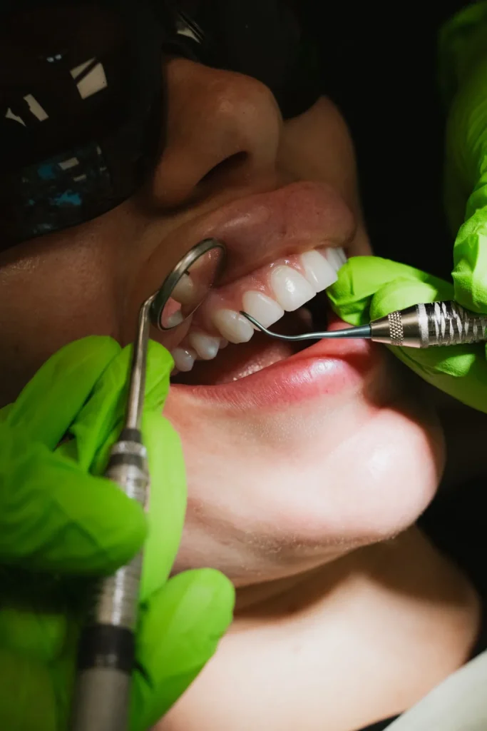 Nettoyage dentaire effectué par un dentiste lors d’un examen en clinique dentaire