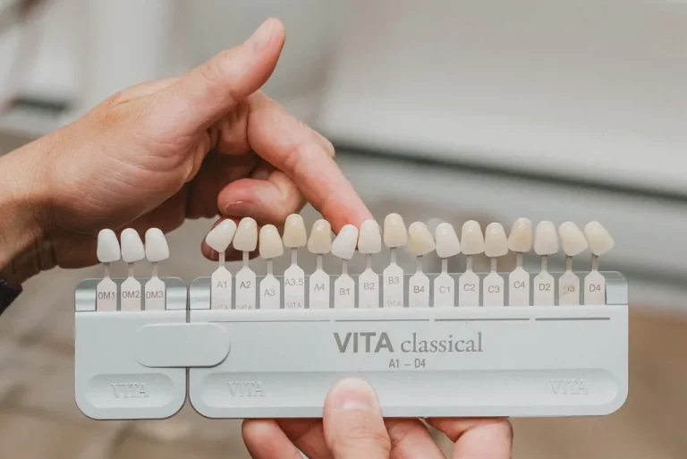 Dentiste utilisant un teintier dentaire pour sélectionner la couleur des dents d’une patiente
