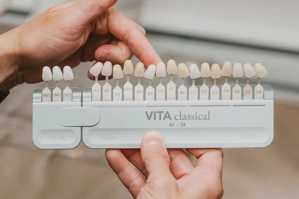 Sélection de la teinte des dents avec nuancier VITA Classical au Centre dentaire Boucherville