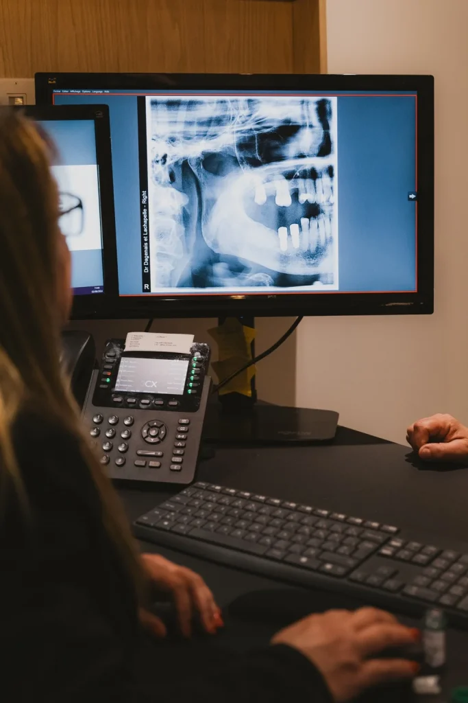 Analyse d’une radiographie dentaire affichée sur un écran lors d’une consultation.