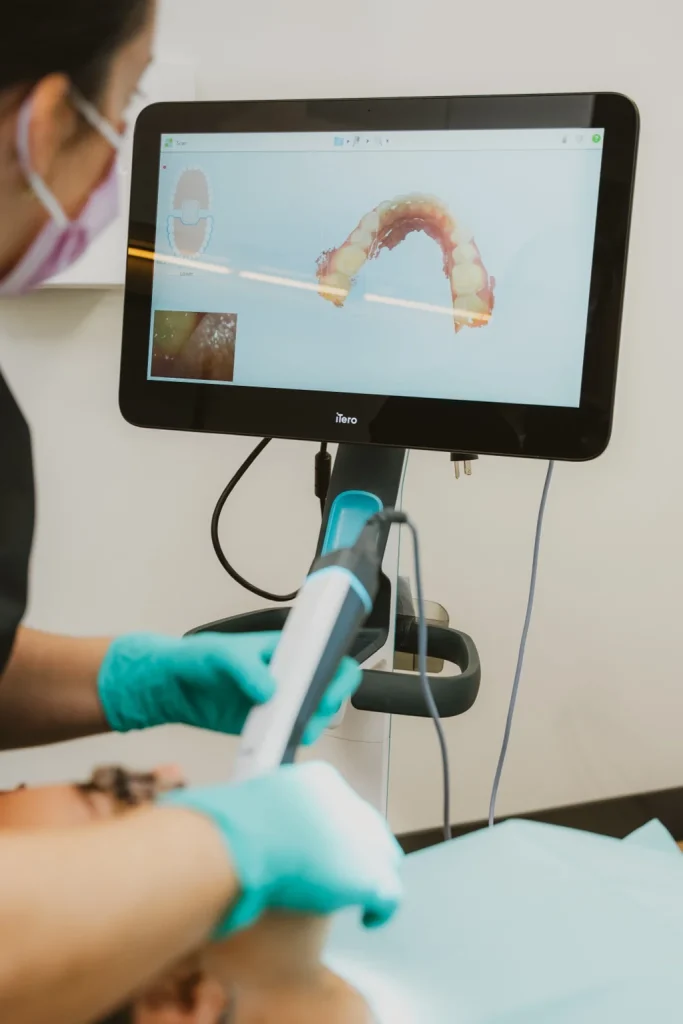 Numérisation intraorale 3D réalisée avec un scanner iTero lors d’un examen dentaire.