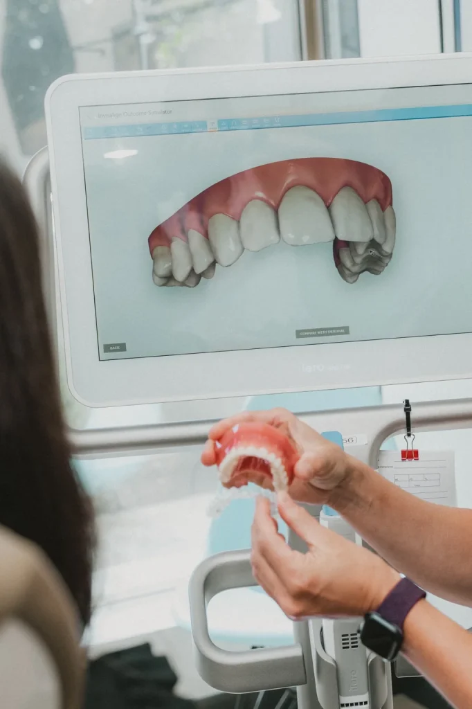 Simulation 3D du résultat d’un traitement Invisalign présentée à une patiente